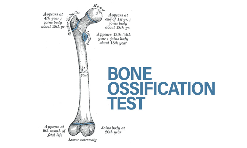 Demystifying The Bone Ossification Test In Criminal Jurisprudence