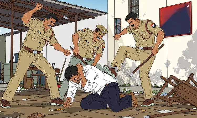 Custodial Death | Gauhati HC Awards ₹25 Lakh Compensation To Businessmans Widow, Says Pending Trial Against Cops No Bar Custodial Death | Gauhati HC Awards ₹25 Lakh Compensation To Businessmans Widow, Says Pending Trial Against Cops No Bar