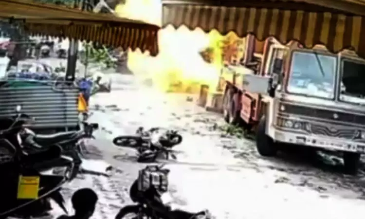 MP High Court Directs State To Airlift Gas Pipeline Blast Victim To Ahmedabad, Bear Entire Treatment Cost
